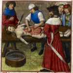 Daily History Picture: Medieval Autopsy